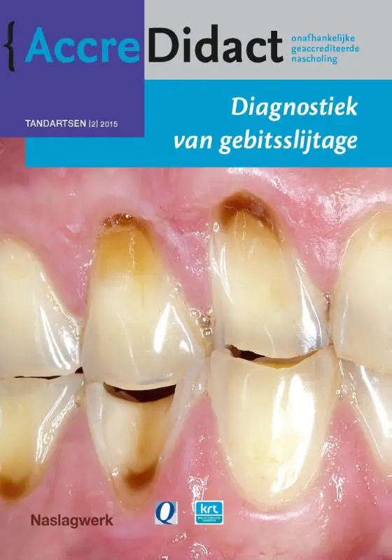 Diagnostiek van gebitsslijtage